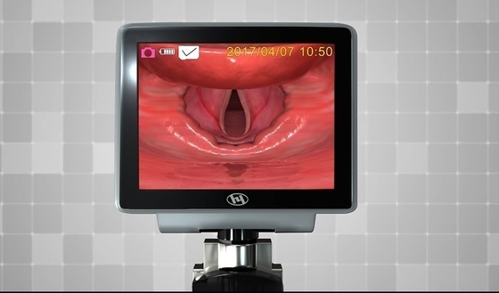 HYHJ 1320 منظار الحنجرة ذو الفيديو والألياف البصرية البلاستيكية مع شفرات يمكن التخلص منها