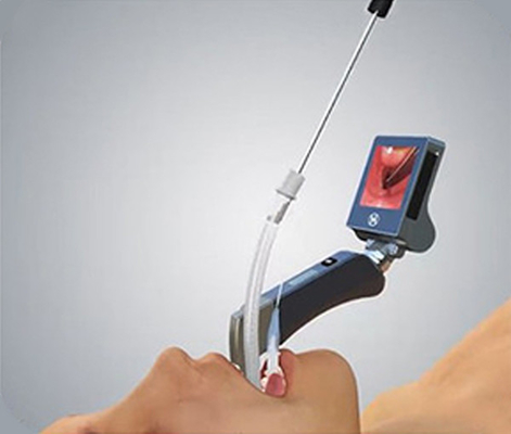 5 شفرات غير قابلة للصدأ قابلة لإعادة الاستخدام منظار الحنجرة بالفيديو - Haiye Medical Equipment