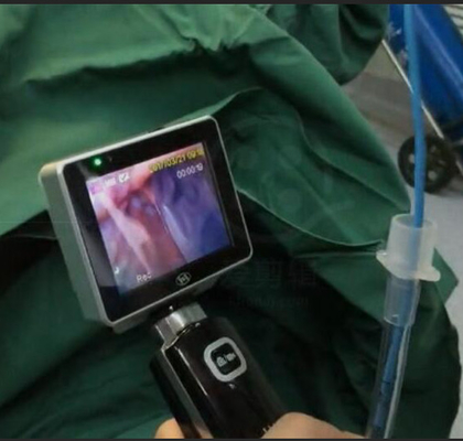 ICU EMS منظار الحنجرة ذو الاستخدام الفردي بالفيديو مع دقة كاميرا 1280 × 720