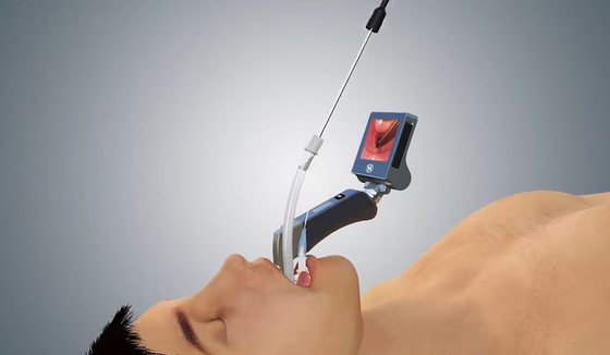 قسم التخدير المحمول Haiye Video Laryngoscope 1060 Hpa