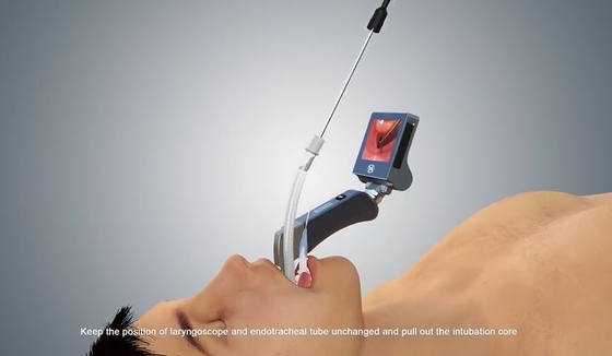 منظار الحنجرة بالفيديو من Haiye Medical يمكن التخلص منه باستخدام USB EMS مع 6 شفرات معدنية