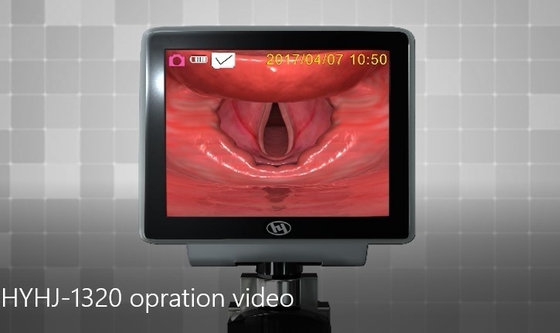 الكمبيوتر الطبي لمكافحة الضباب عدسة الفيديو المتاح منظار الحنجرة في طب الأطفال